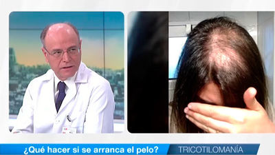 Tricotilomanía, ¿Qué hacer si se arranca el pelo?