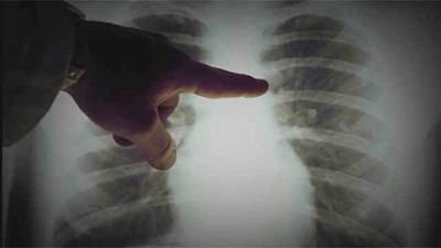 Más de un siglo de radiografías