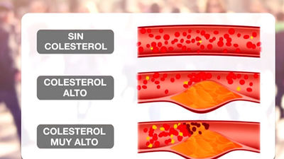 Colesterol: la grasa que puede frenarte