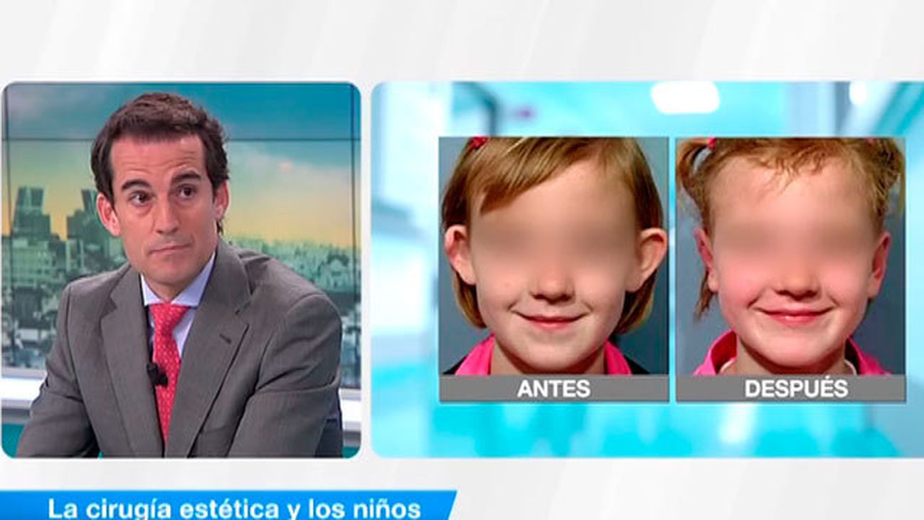 La cirugía estética y los niños