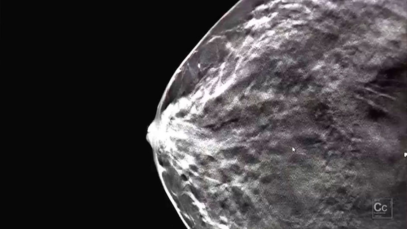 ConCiencia: Derrotando al cáncer