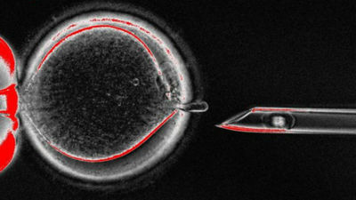 Ensayan un trasplante mitocondrial para evitar enfermedades hereditarias