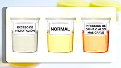 Una vacuna para la infección de orina