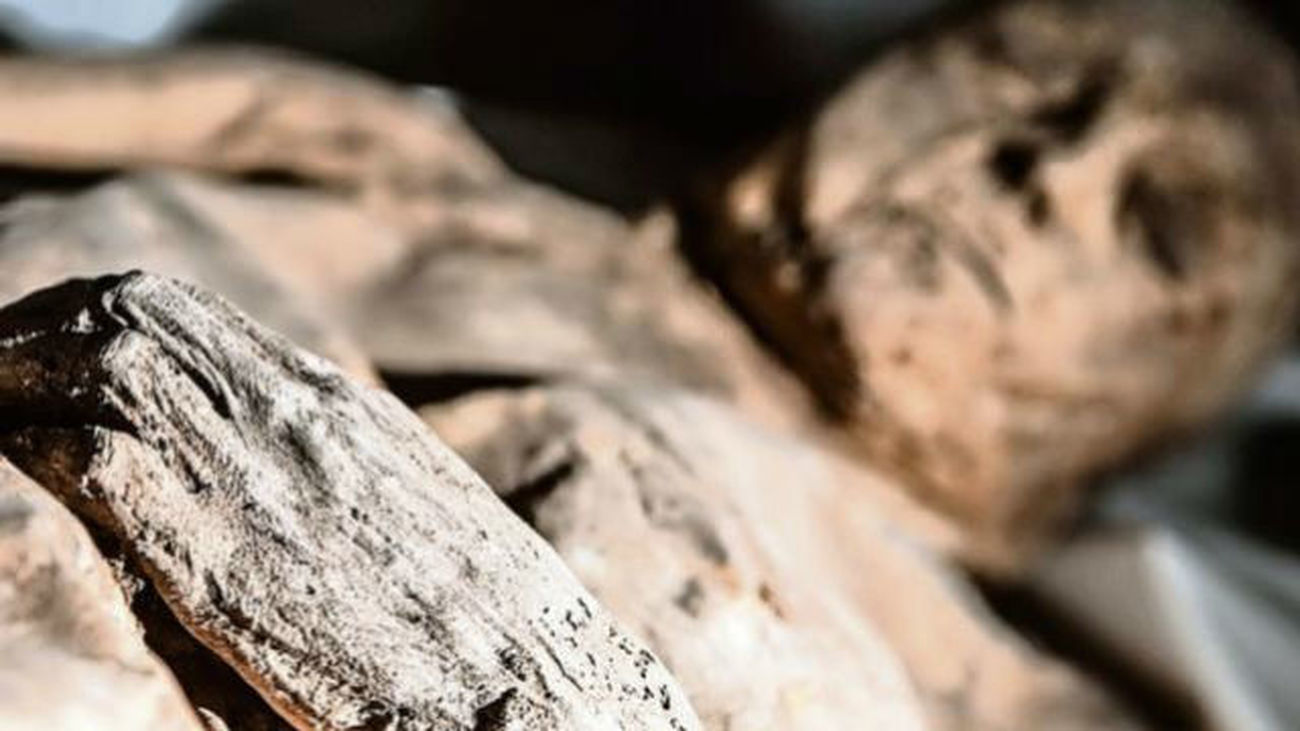 Una viruela en una momia del siglo XVII pone en duda la historia de esta enfermedad