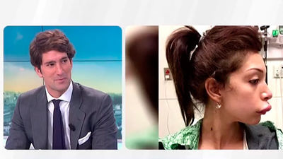 ¡Cuidado!, el lowcost en estética puede salirnos caro