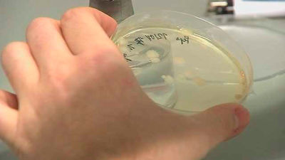 Escualamina, un compuesto del hígado de tiburón que puede ayudar contra el Parkinson