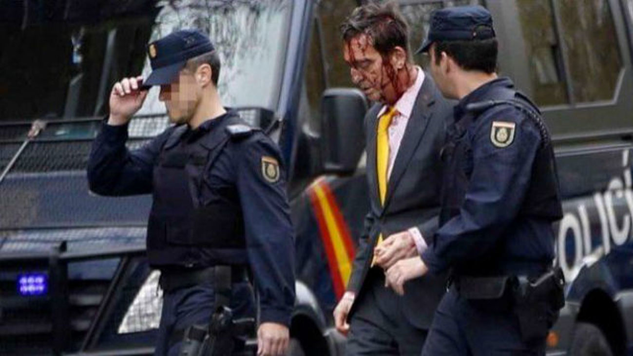 Dos detenidos como presuntos autores del asalto a la clínica del cirujano Ignacio Frade