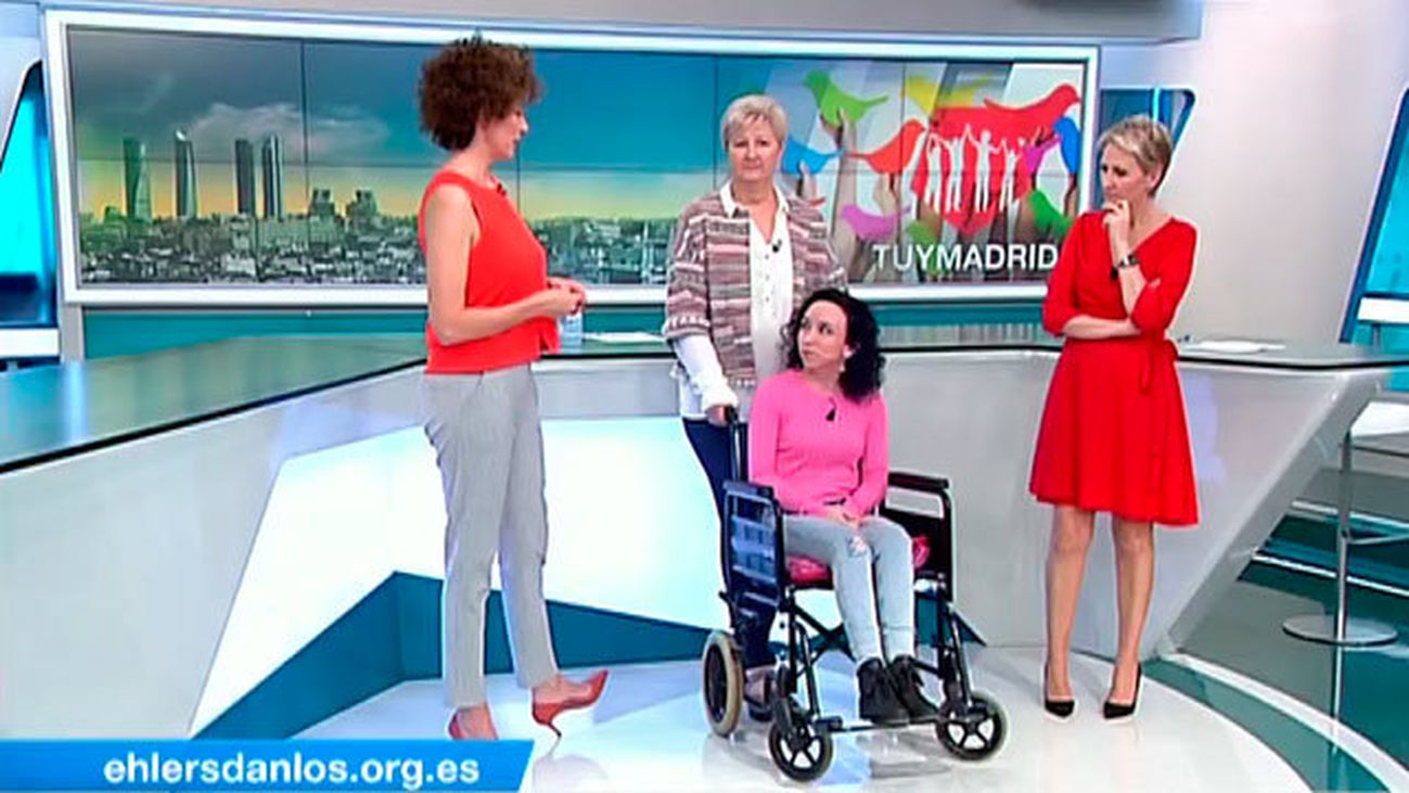 Qué es el Ehlers-Danlos