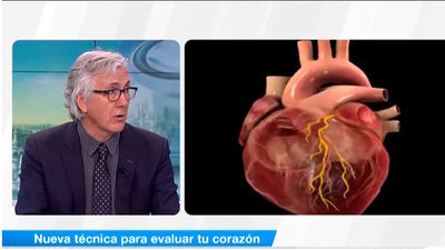 Las nuevas técnicas para evualuar el corazón