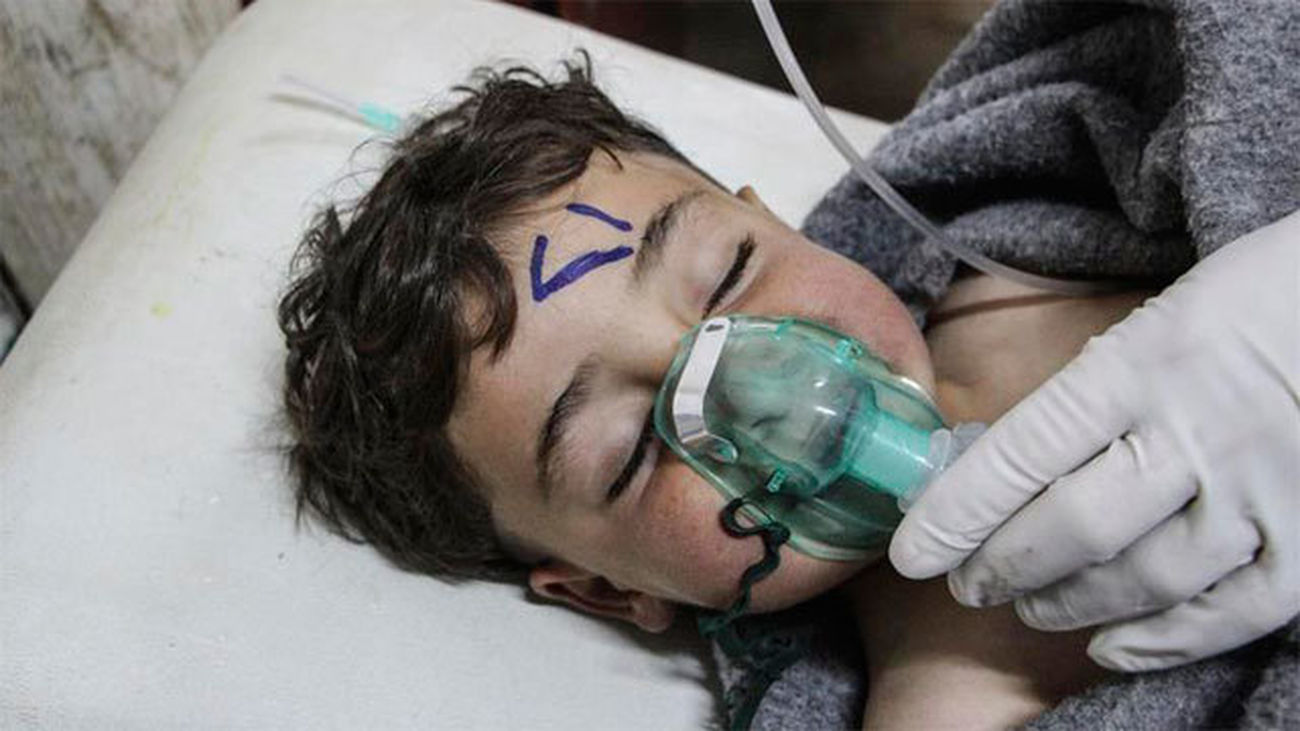 Un niño recibe tratamiento médico tras un supuesto ataque químico contra la localidad de Jan Shijún