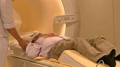 La neuroimagen puede predecir el alzhéimer con 15 años de antelación