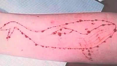 Hospitalizada una menor en Barcelona por participar en un reto suicida