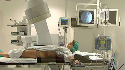 Litotricia ambulatoria