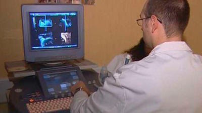 Los avances quirúrgicos en cáncer de ovario han incrementado  la supervivencia de las afectadas