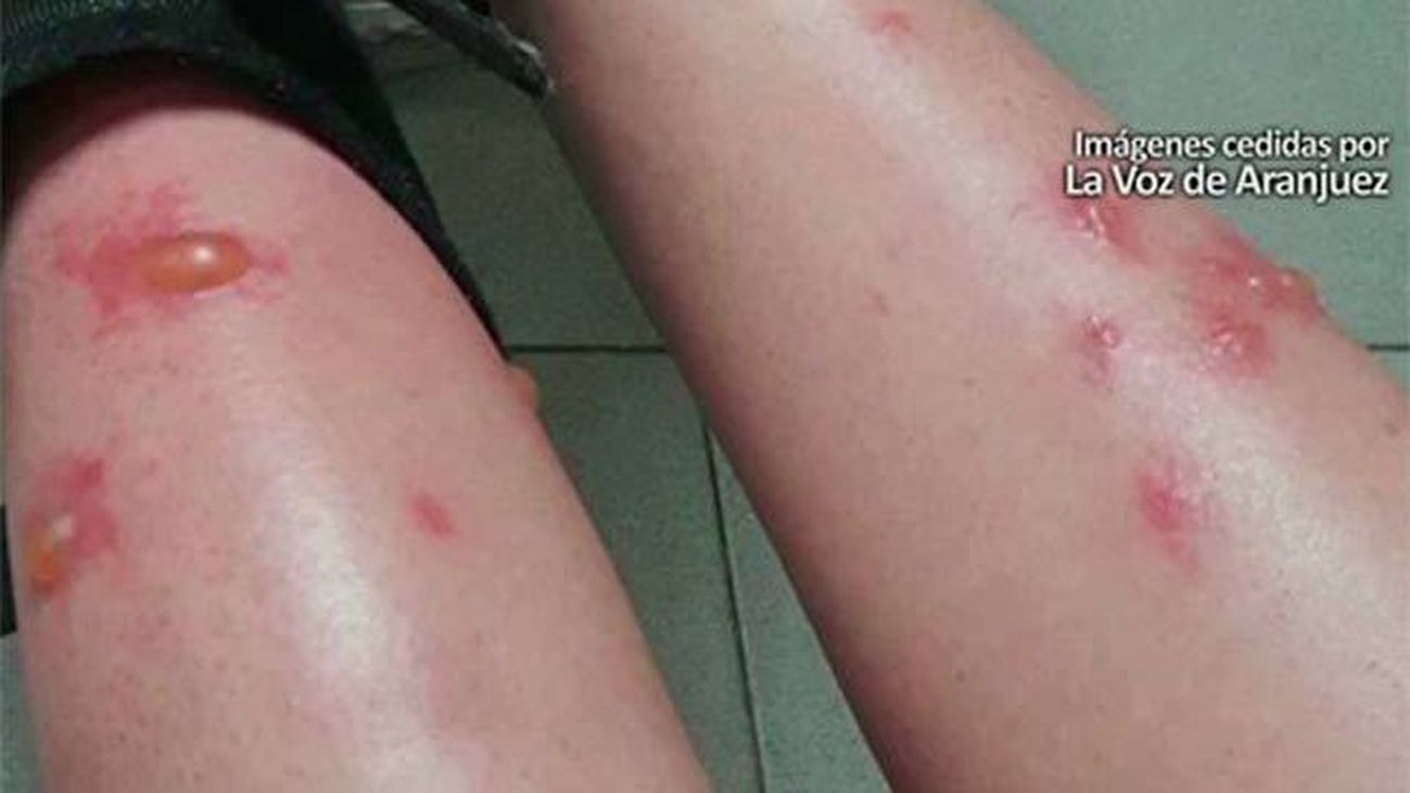 Los vecinos de Aranjuez, acribillados por la mosca negra