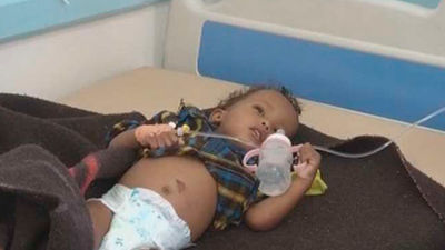 La OMS estima que hay 360.000 personas infectadas de cólera en Yemen