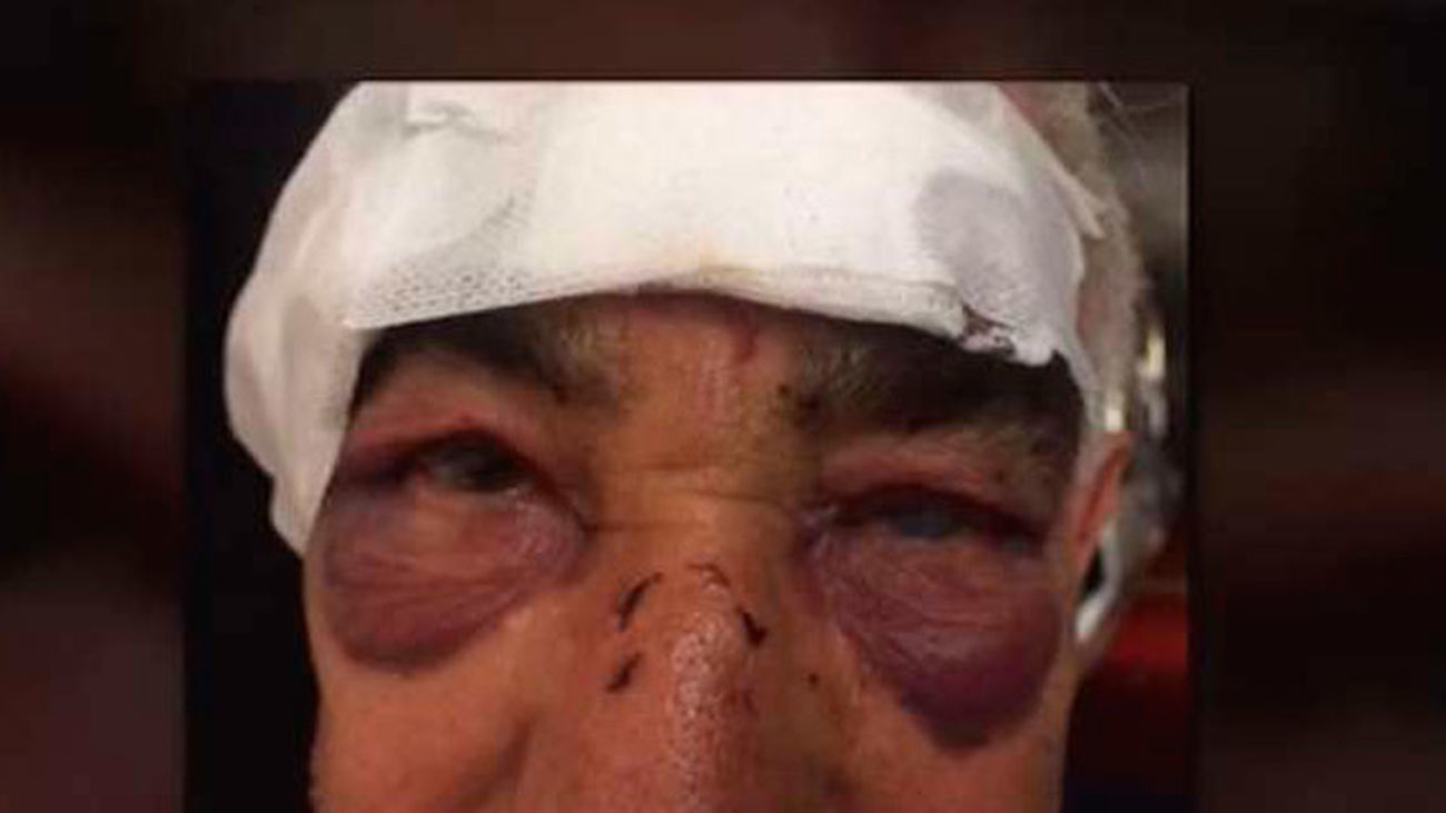 Una banda de ladrones violentos atemoriza a los vecinos del Viso de San Juan