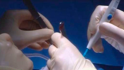 Manos milagrosas en el hospital Doce de Octubre