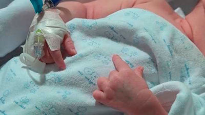 Carla, primer bebé español en recibir un corazón incompatible con su sangre