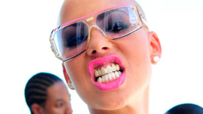 Cuidado con el Bling, la moda de los dientes