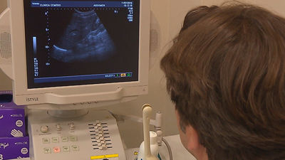 Radiología: Riesgos y beneficios