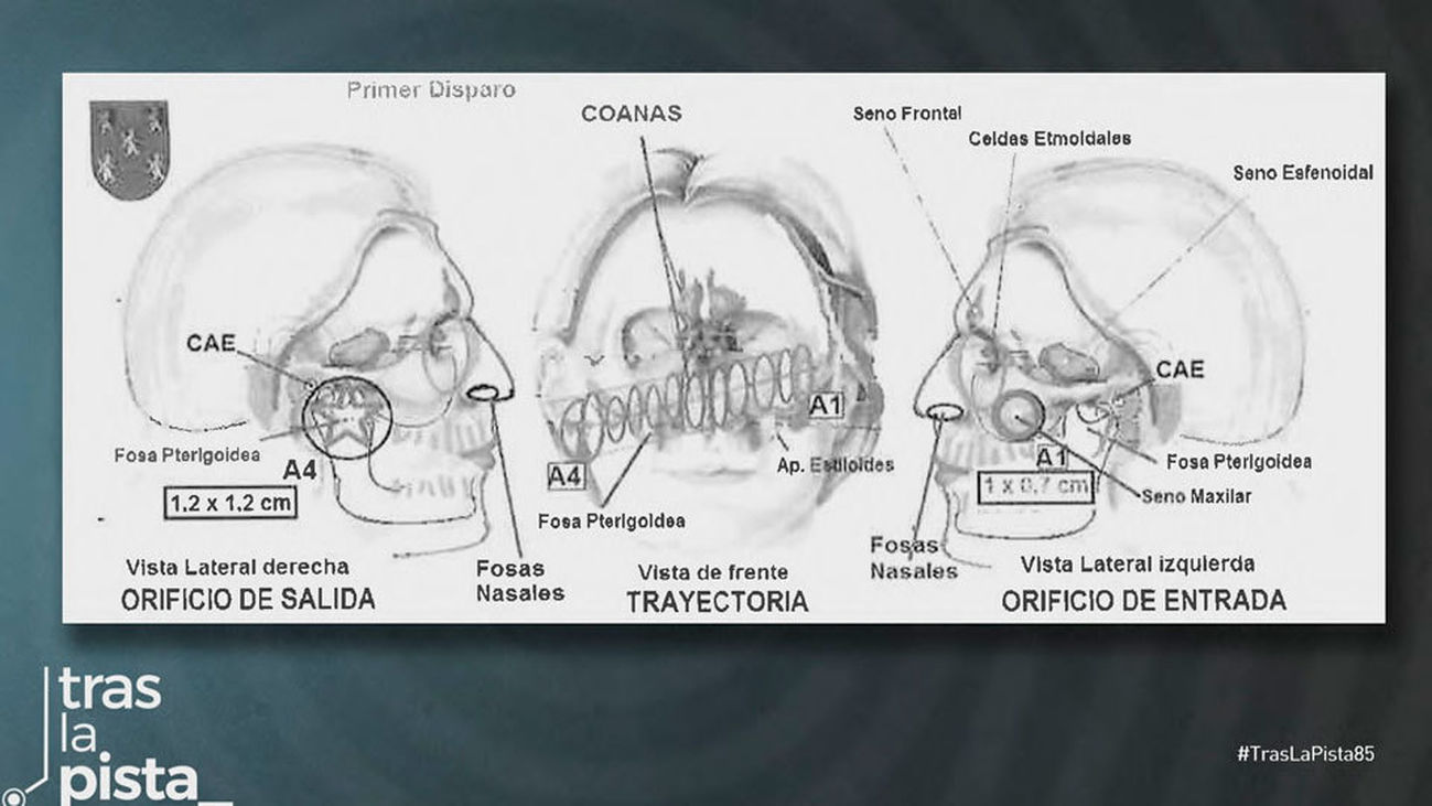 ¿Y si el crimen de la viuda del banquero fue un robo que acabó en asesinato?