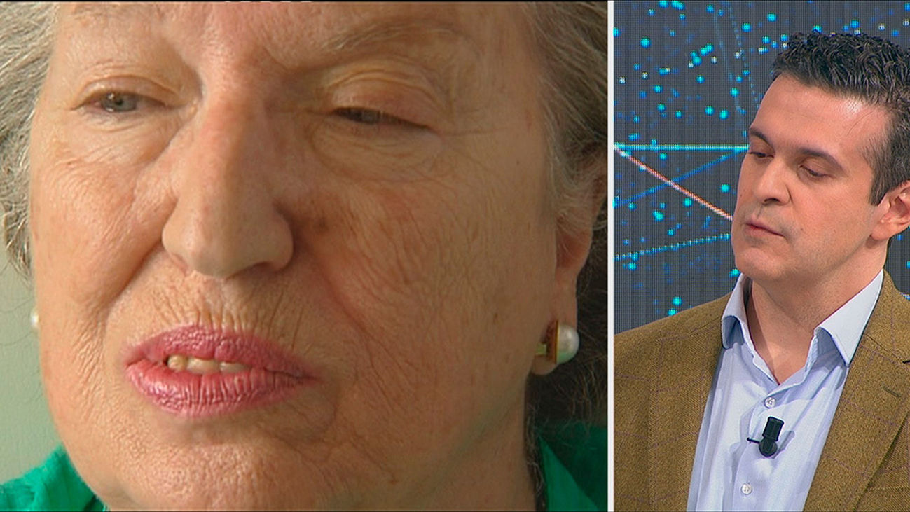 Parálisis facial, no solo un problema estético