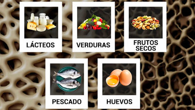 Alimentos contra la osteoporosis