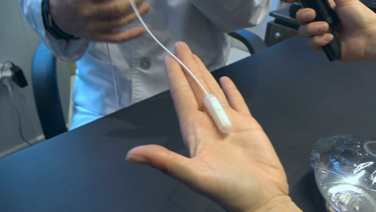 Elipse, el balón intragástrico que permite perder hasta 15 kilos en unos meses