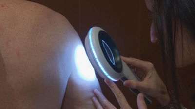 Los dermatólogos alertan del aumento de enfermedades de transmisión sexual