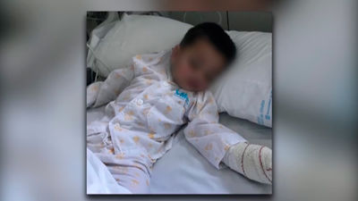 Un perro muerde a un niño de 19 meses en Alpedrete y el dueño se da a la fuga