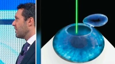 En los últimos años los casos de miopía se han duplicado en España