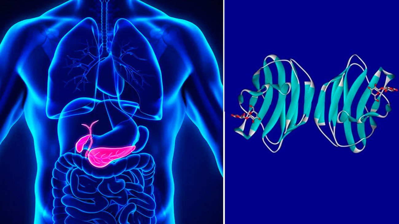 Inhibir la 'Galectina-1' podría ser el primer tratamiento efectivo para frenar el cáncer de páncreas