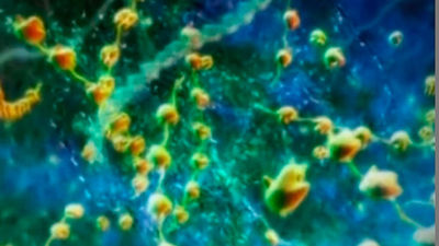 Tres mil personas fallecen en España por infecciones que los antibióticos no atajan