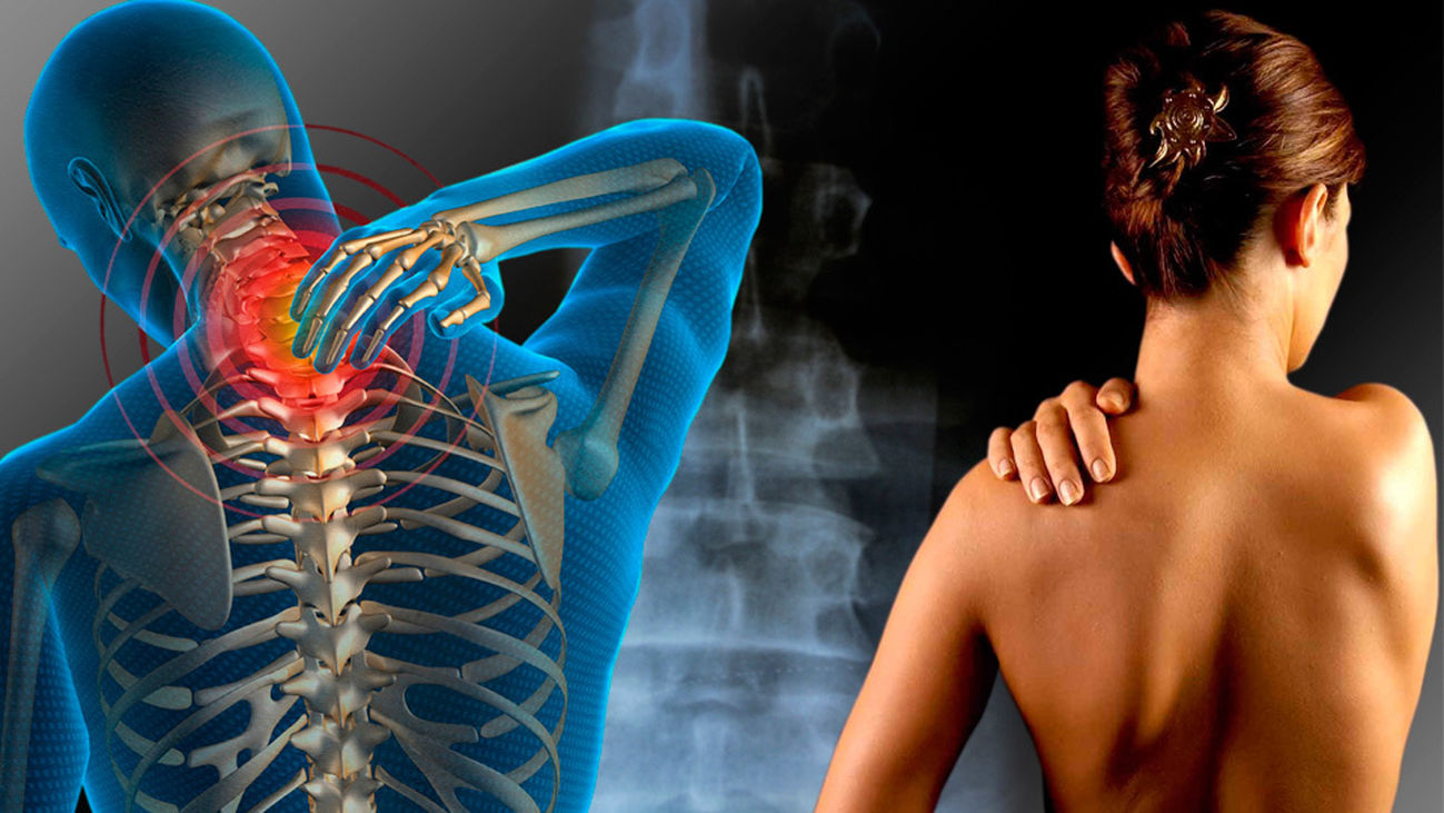 Dolor cervical, ¿cómo combatirlo?