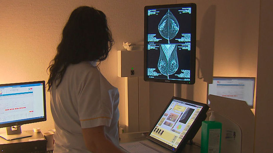 Atención integral a las pacientes de cáncer de mama