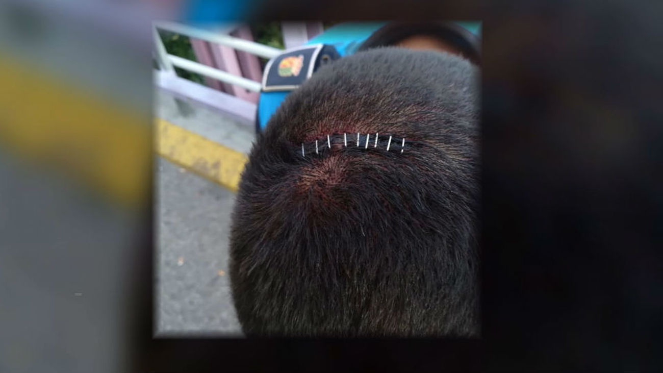 Brutal agresión a cuatro policías municipales de Getafe