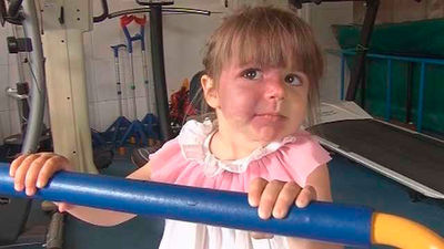 Pía, viviendo con medio cerebro