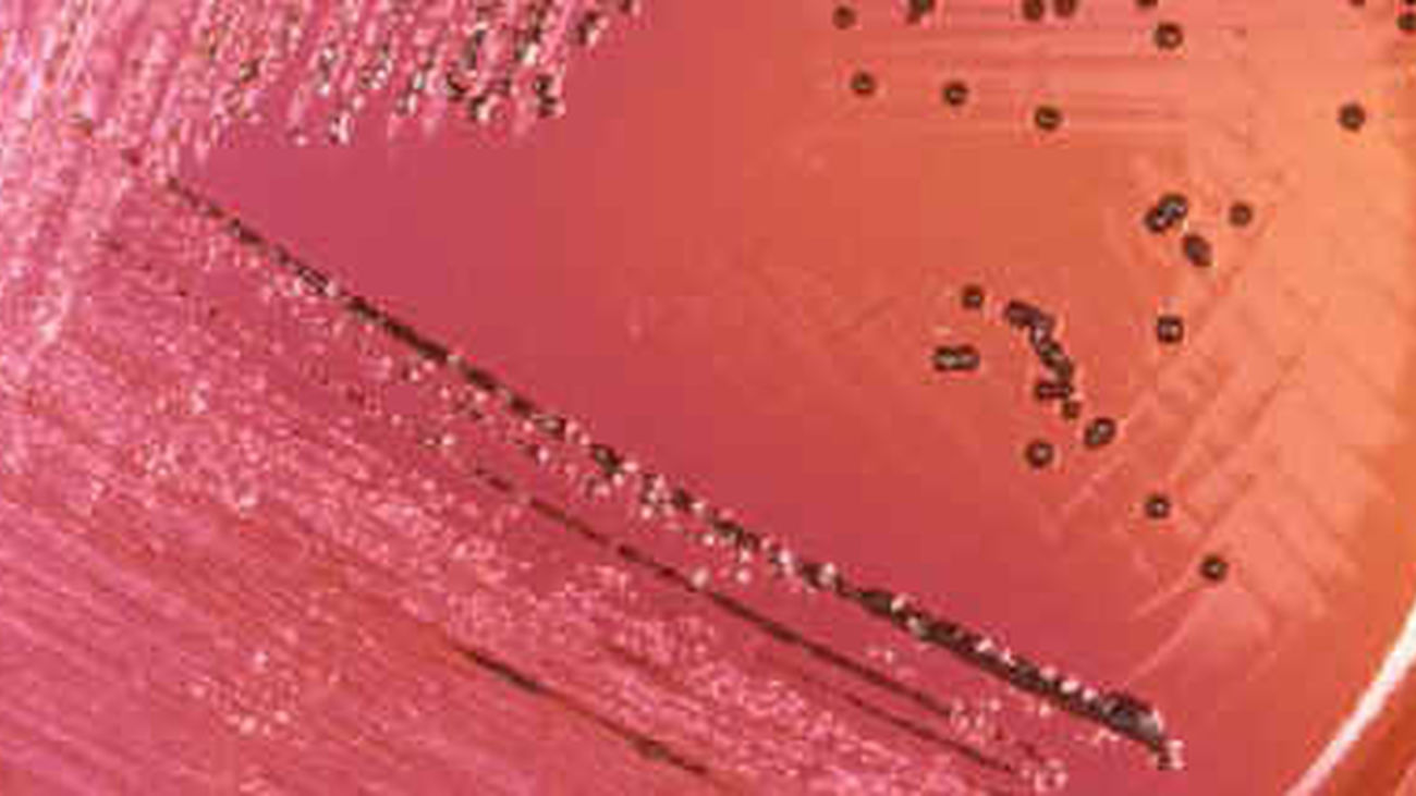 Una intoxicación alimentaria en Madrid Río se salda con 28 ingresos hospitalarios de ecuatorianos