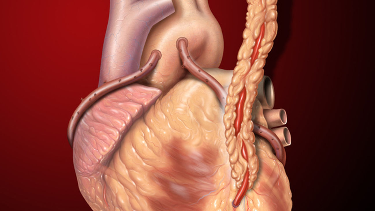 Desarrollan un test genético que predice el riesgo de sufrir un infarto