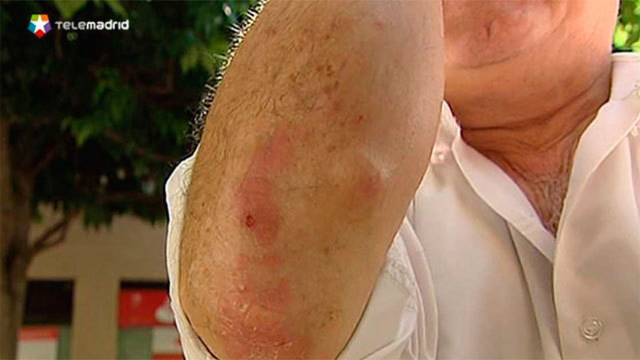 Alerta por una plaga de mosquitos y moscas negras en el sureste de la Comunidad