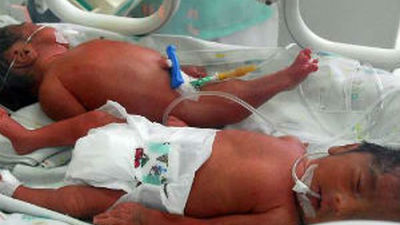 Cerrada temporalmente la UCI de neonatos de La Paz por un brote bacteriano