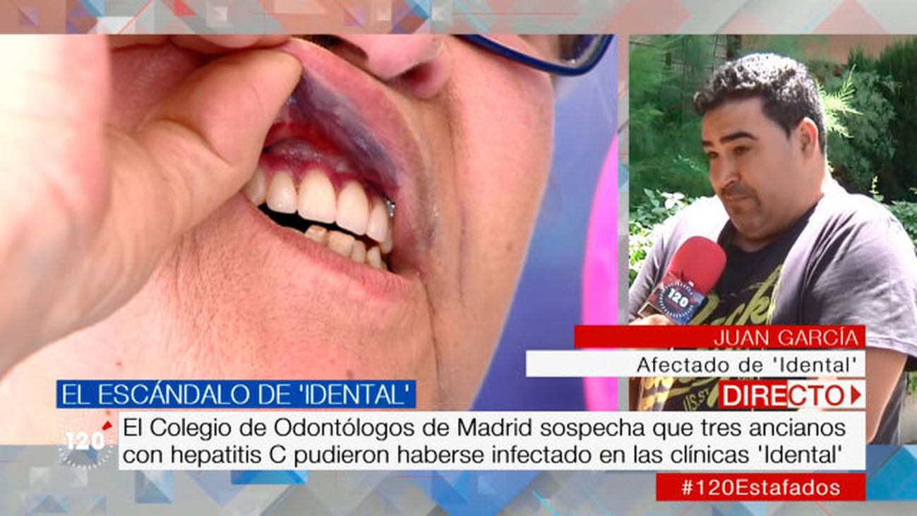 Juan, afectado por el escándalo de iDental: “Para ellos hemos sido como ratas de laboratorio”