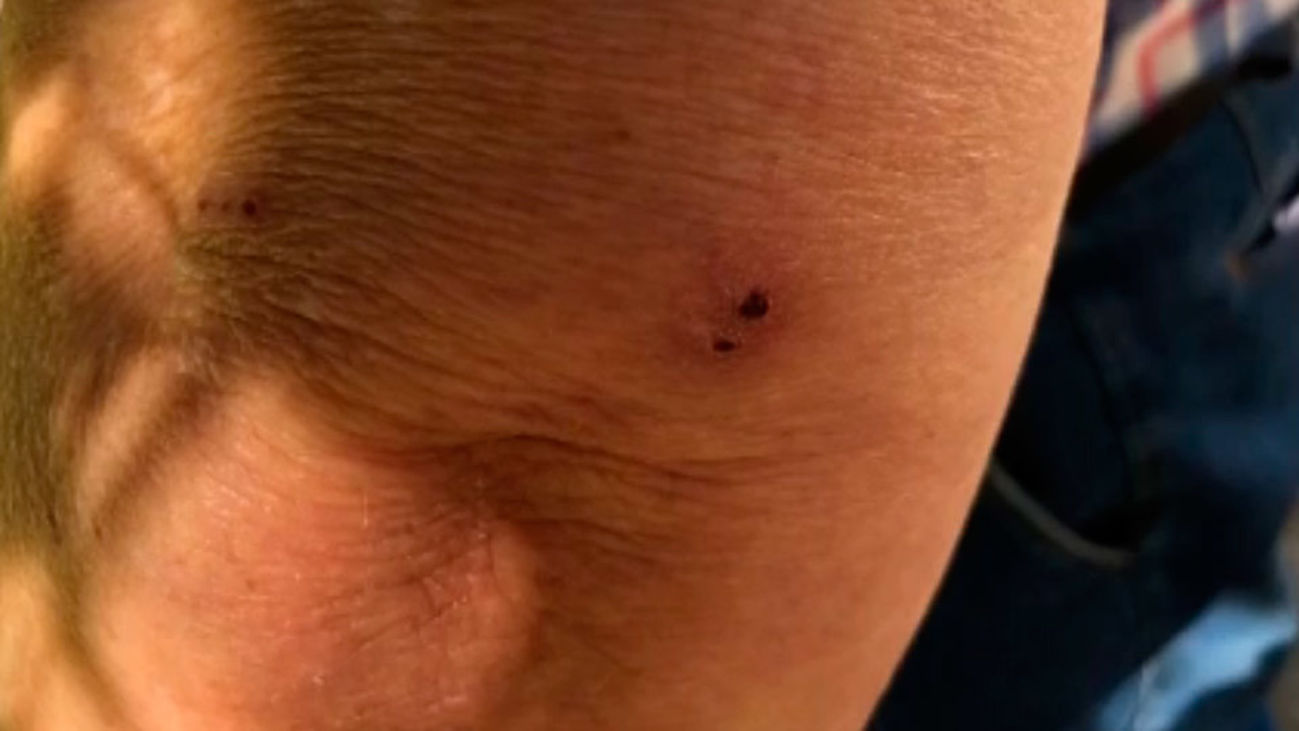 Plaga de mosquitos en Aluche