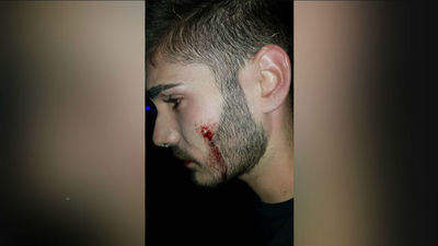 Nueva agresión homófoba  a un joven en una discoteca de Alcorcón