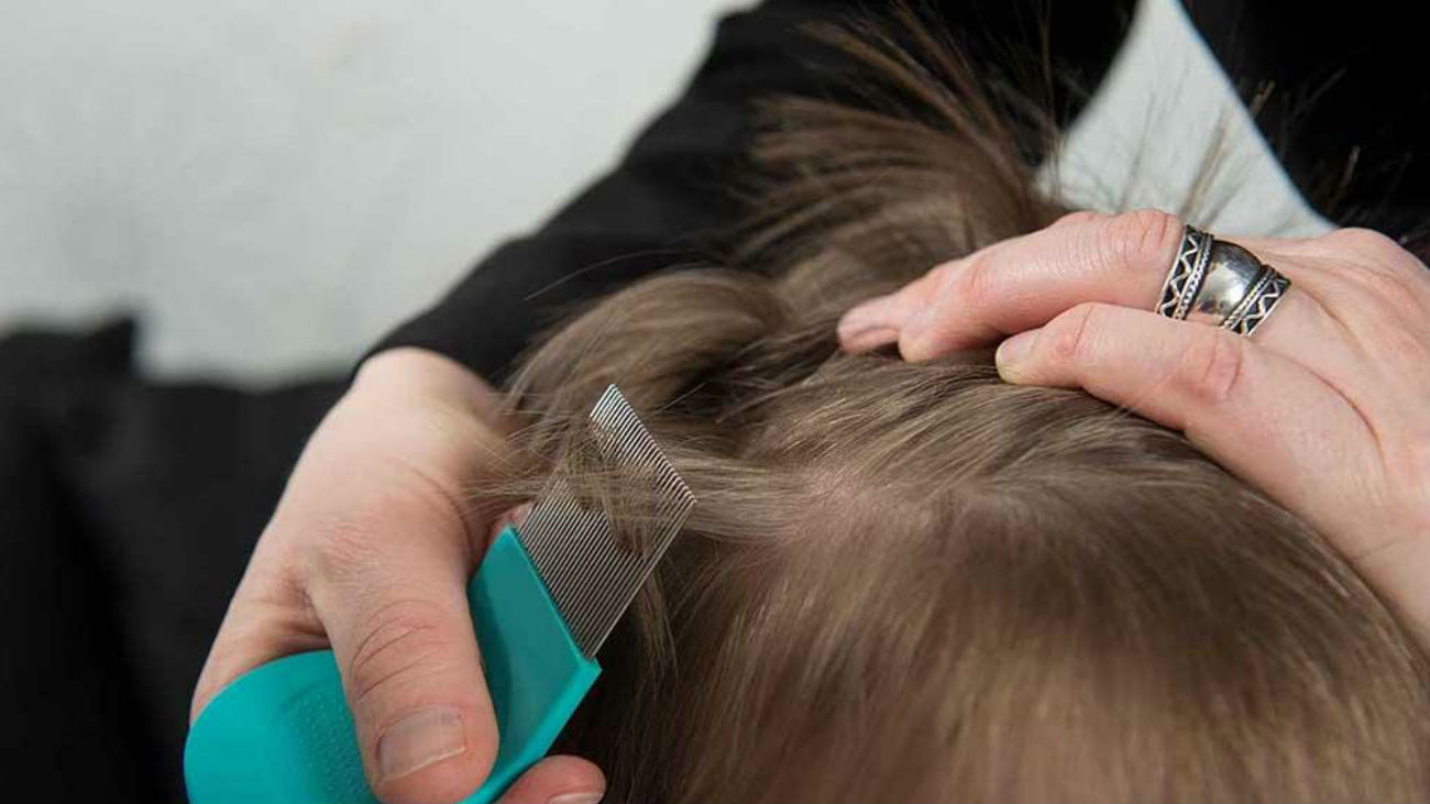 ¿Tienen solución los piojos?