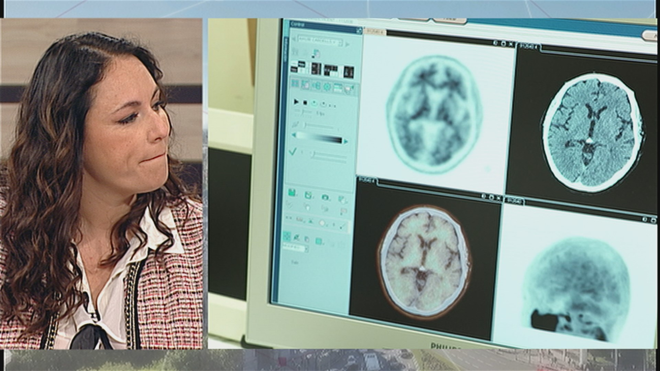 ¿Habrá vacuna contra el alzheimer?