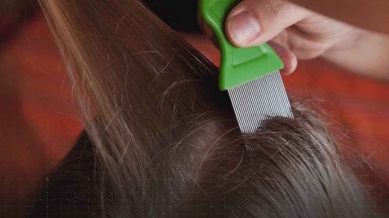 Destapamos los falsos mitos sobre los piojos