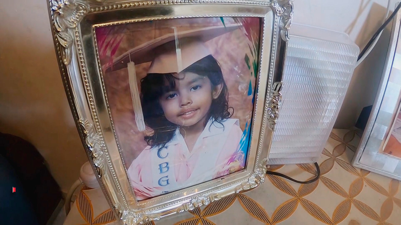 Andrea, una niña panameña que tiene un tumor de más de 30 centímetros en la espalda