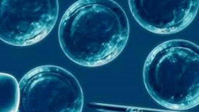 Eliminan el virus del Sida en seis pacientes con trasplantes de células madre